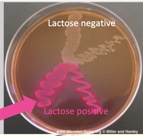 B48 Gram Negative Bacilli Lactose Positive Enteric Bacilli Flashcards