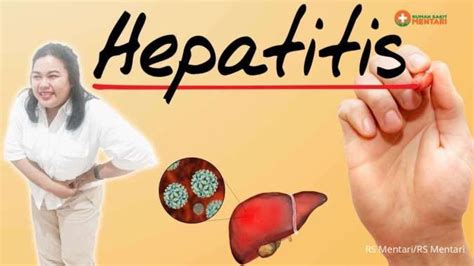 Hepatitis Atau Peradangan Hati Penyebab Gejala Dan Pencegahannya