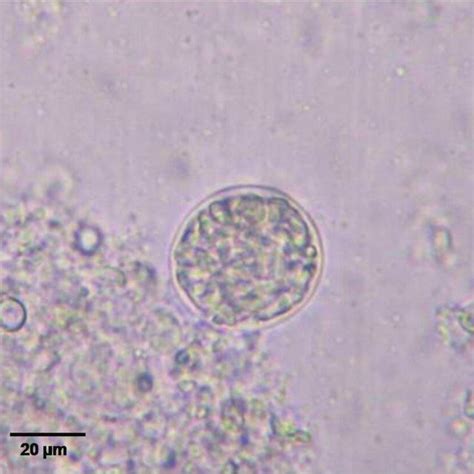 Toxoplasma Gondii Oocysts In A Cat Stool Sample Note Three