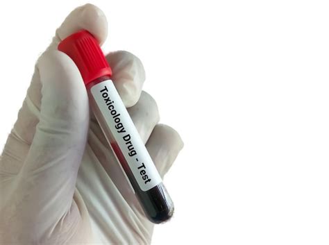 Bioquímico segurando amostra de sangue fundo branco para teste de