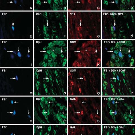 Fluorescent Micrographs Showing Er Subtypes B F J N And C G