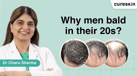 Kya 20s Mein Hair Loss Hona Normal Hai Dr Charu Sharma Head Of