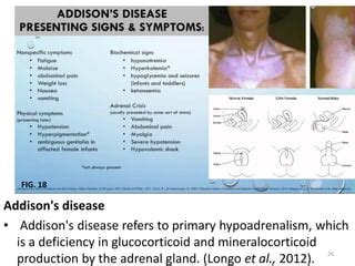 Embryology Of Pineal And Adrenal Gland By Zachariah Richard Ppt