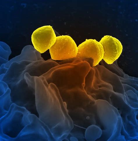 Streptococcal Pharyngitis Bacteria Shape