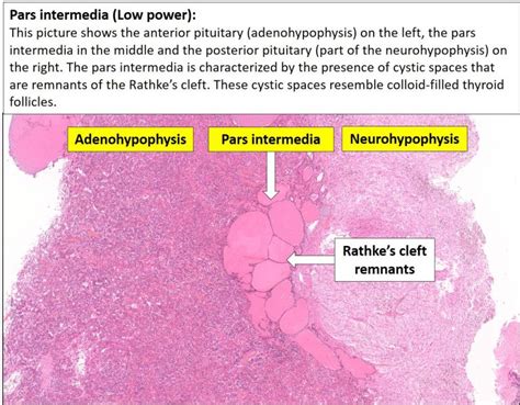 Brain Pituitary Nus Pathweb Nus Pathweb