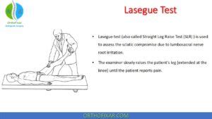 Lasegue Test Straight Leg Raise Test