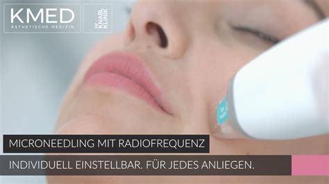 POTENZA RF Microneedling Innovative Hautverjüngung und