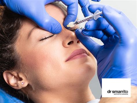 Rhinoplastie médicale Lausanne se refaire le nez