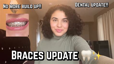 Braces Vlog Update On My Journey Got A Deep Cleaning No More Build