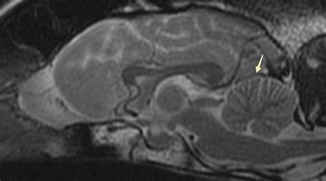 Term: Tentorium cerebelli - NeuroPetVet