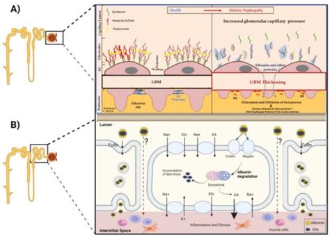 Cells Free Full Text Diabetic Proteinuria Revisited Updated