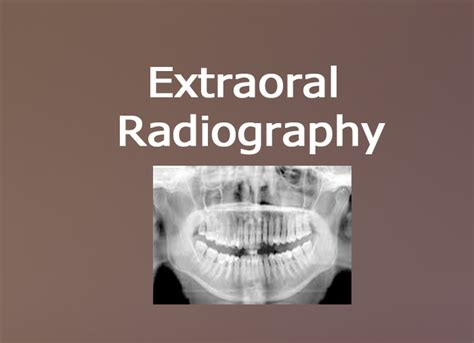 Extraoral Radiography Focus Dentistry