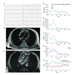 Multiple Organ Injuries Characterized By Myocarditis And Myositis