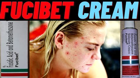 Fucibet Cream Use In Hindi How To Use Fucibet Cream Side Effects And