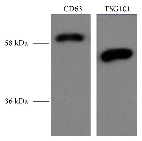 Validation of exosomes isolated from serum samples. (a) Morphological ... 