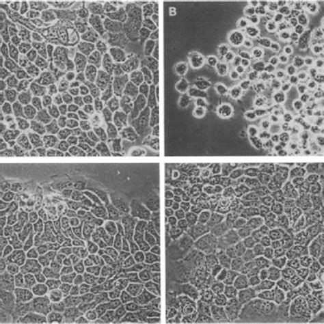 Effect Of EGF On A 431 Cell Shape In The Presence Or Absence Of Ca