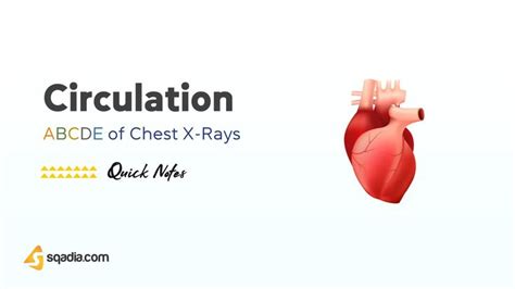 ABCDE of Chest X-Rays - Circulation [Video] | Educational videos, X ray, Medical videos