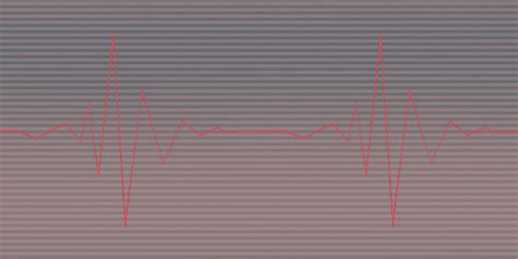 Detak Jantung Gelombang Pada Monitor Jantung Medis Ekg