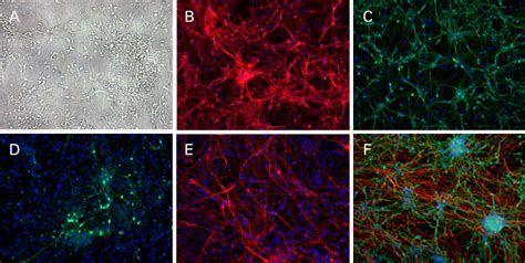 Rhb A Neural Stem Cell Culture And Differentiation Medium