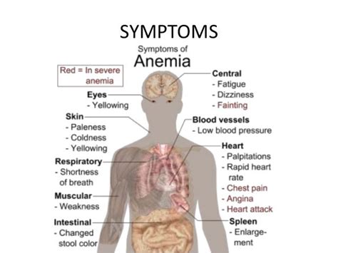 Hypochromic Anemia