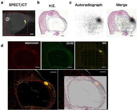 A SPECT CT Image Shown In Fig 4c Rotated 90 Anti Clockwise For