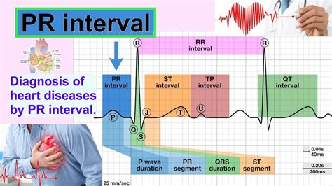 Pr Interval Youtube