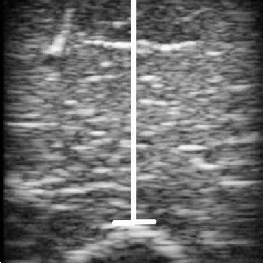 Elbow Flexion Range Of Motion ROM Performed From Both Training Groups