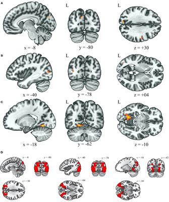 Frontiers Altered Functional Connectivity And Sensory Processing In