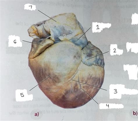 Heart Dissection Flashcards Quizlet