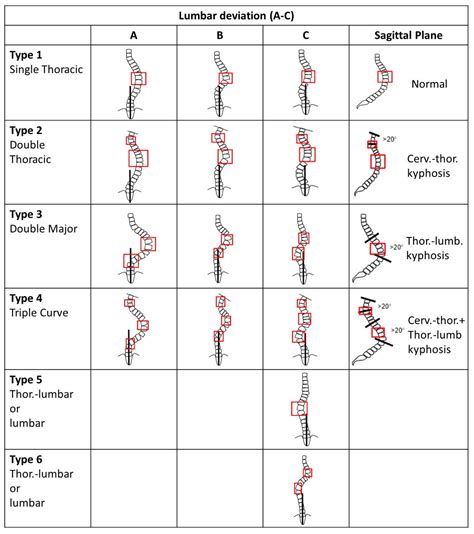 Adolescents Free Full Text Scoliosis Causes And Treatments