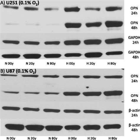 Western Blot Showing Opn Expression Under Normoxic N O And