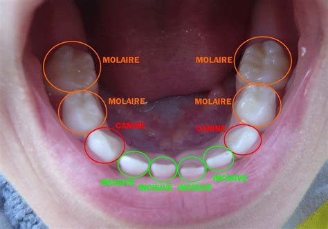 Ecole Primaire Publique De Vincy Les Dents Dents Santé Bucco