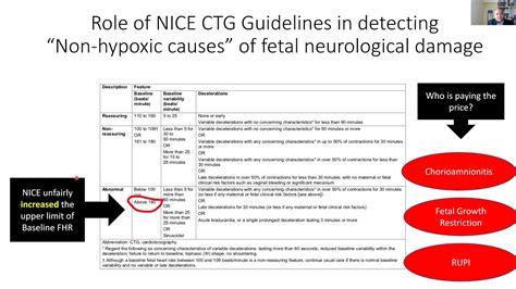 Quo Vadis Fetal Heart Rate Monitoring Nice Ctg Guideline Vs