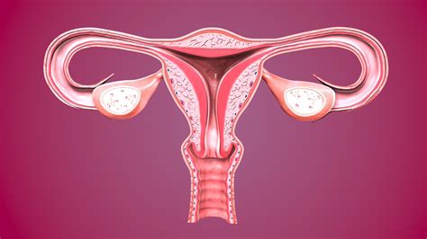Vaginal Bleeding | Uterine Fibroids | MedlinePlus