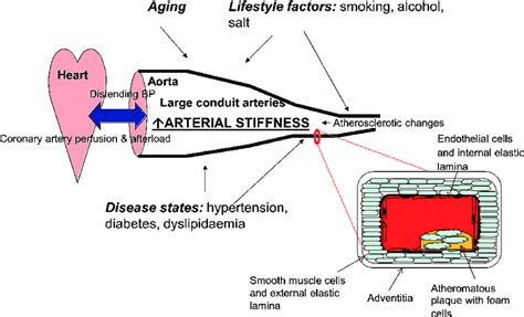 Determinants of arterial stiffness. | Download Scientific Diagram