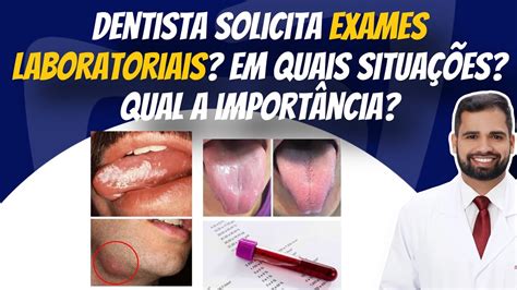 Exames Laboratoriais Em Quais Situa Es O Dentista Deve Solicitar