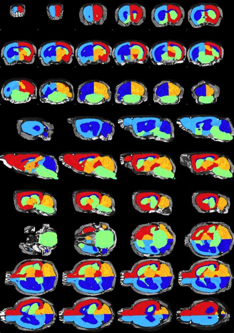 Multi Template MRI Mouse Brain Atlas Dataset Papers With Code