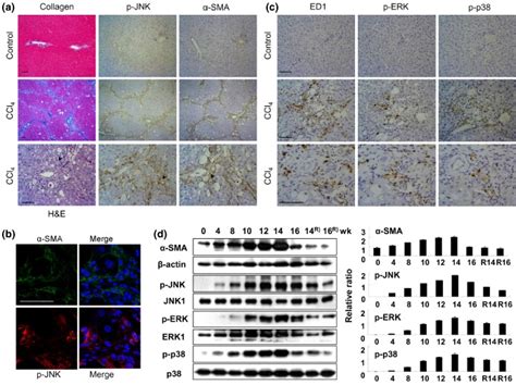 Immunohistochemical findings for α SMA and p JNK in CCl4 induced liver