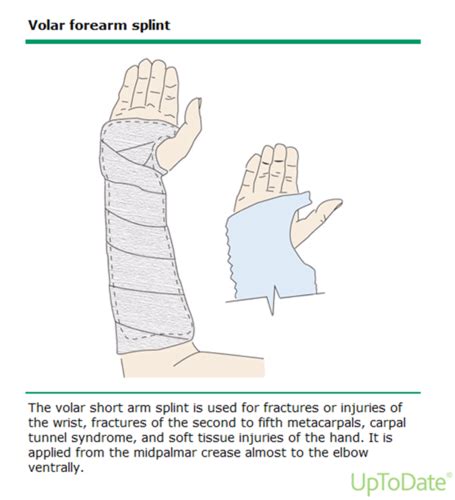 NGR 5064 Splinting Extremities Ch 58 Campo Flashcards Quizlet