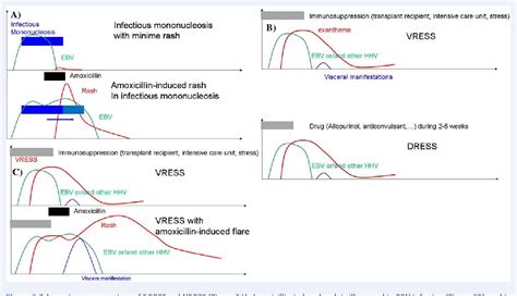 [PDF] Severe Amoxicillin-Induced Rash and EBV reactivation: DRESS or ...