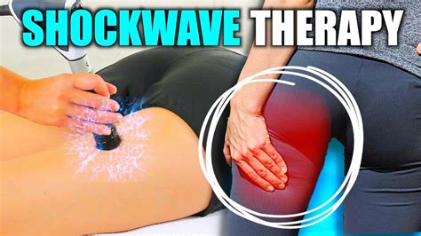 Should You Try Shockwave Therapy For PHT Recovery Overcoming