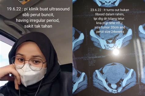 Gadis Berjaya Buang Fibroid Selepas Haid Tak Teratur Perut Buncit