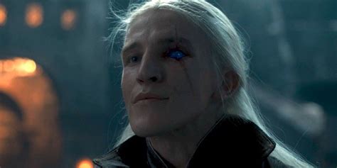 10 Best Things About Aemond Targaryen In House Of The Dragon