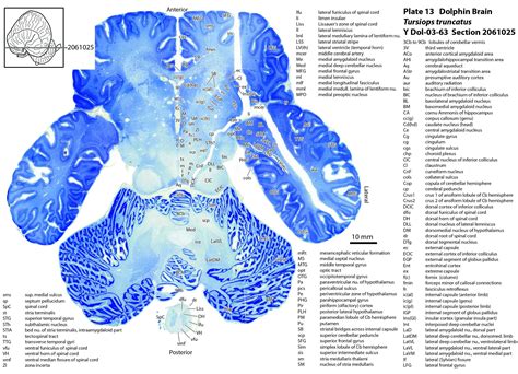 Atlas of the Brain of a Dolphin — Comparative Brain Anatomy