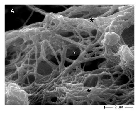 Scanning Electron Microscopy Sem Micrographs Of Extracellular Matrix Download Scientific