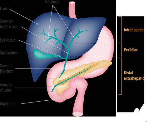 Gallbladder Pain Location Diagram - exatin.info