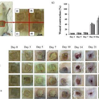 Histological Images Of Post Burn Full Thickness Wound After Treated