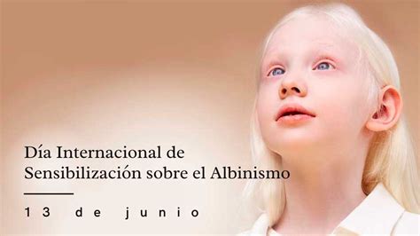 13 de junio Día Internacional de Sensibilización sobre el Albinismo