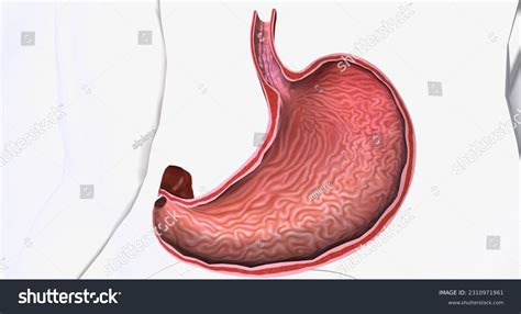 40 Imágenes De Esophageal Varices Imágenes Fotos Y Vectores De Stock