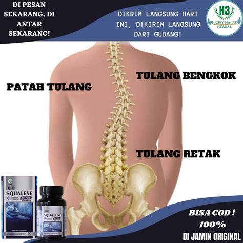 Obat Tulang Retak Homecare